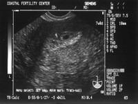 4/18/05
We're really pregnant! There's something in there.